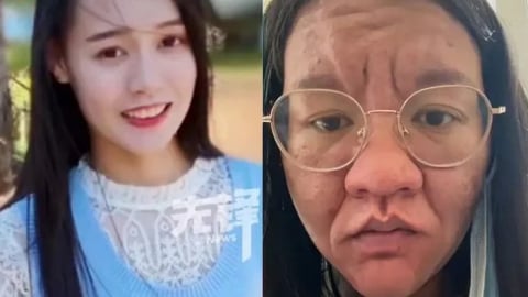 Khuôn mặt biến đổi khi mang thai của cô gái trẻ Trung Quốc gây choáng