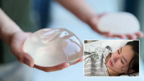 Nhờ phẫu thuật nâng ngực, cô gái thoát chết ngoạn mục