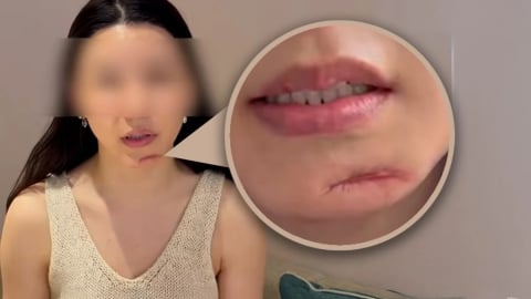 Phẫu thuật thẩm mỹ hỏng, cô gái đòi bồi thường gần 4 tỷ đồng
