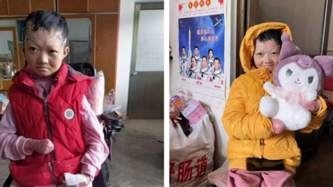 Cuộc đời mong manh của 'cô bé bươm bướm' lay động triệu trái tim
