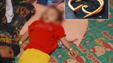 Bi kịch bé gái 4 tuổi tử vong với 1kg giun đũa trong người