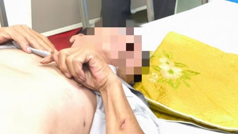Chủ quan không tiêm phòng, nam tài xế nguy kịch vì bệnh dại