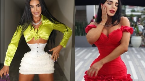 'Búp bê sống' mê siết eo, bị lệch nội tạng khiến giới y khoa chú ý