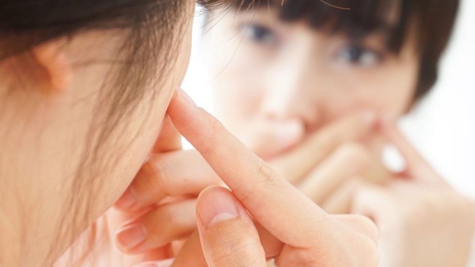 Nặn mụn tùy tiện, cô gái liệt nửa mặt phải cấp cứu