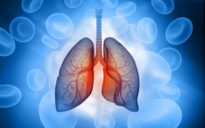 6 dấu hiệu chứng tỏ phổi của bạn không khỏe