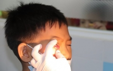 Nguyên nhân nào gây bùng phát bệnh đau mắt đỏ tại TP.HCM?