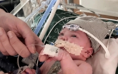 Em bé đầu tiên trên thế giới sống khỏe nhờ ghép một phần trái tim