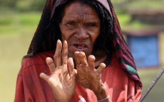 Tục lệ tự chặt ngón tay để thờ chồng của phụ nữ bộ tộc Danai