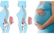Tại sao phụ nữ đau lưng khi mang thai?