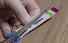 Vụ cắt đôi que thử HIV tại Bệnh viện Xanh Pôn: Phó khoa tự ý chỉ đạo nhân viên