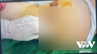 Quyết dẹp nạn thẩm mỹ chui, quảng cáo sai sự thật