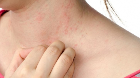 Chuyên gia cảnh báo các bệnh dễ gặp sau mưa bão