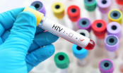 Gian nan nguồn lực để kết thúc đại dịch AIDS